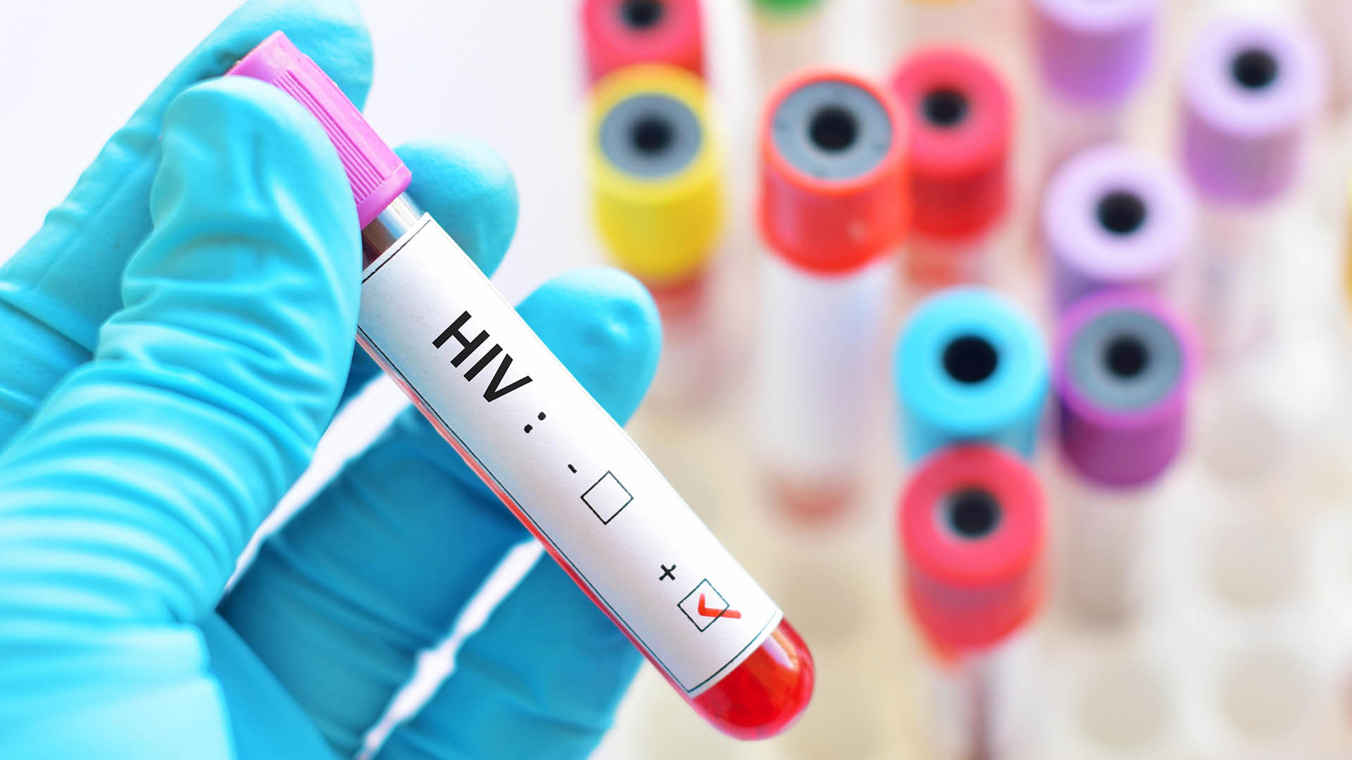 Yearly HIV Vaccine Clears Key Trial Milestone