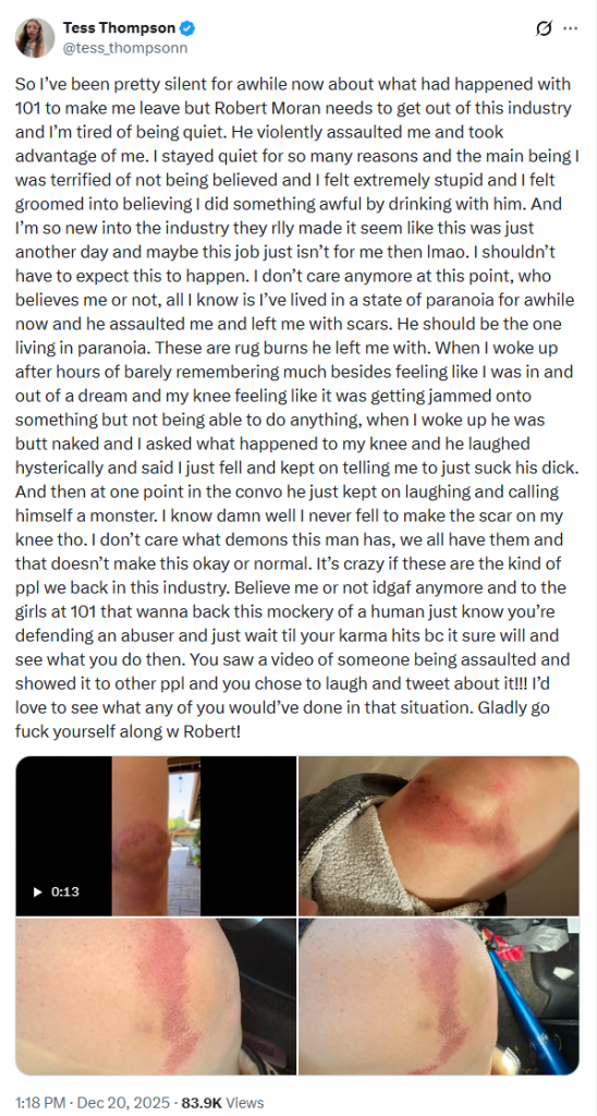 Performer Accuses 101 Modeling of Abuse. The pictures are shocking.