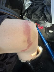 Performer Accuses 101 Modeling of Abuse. The pictures are shocking.