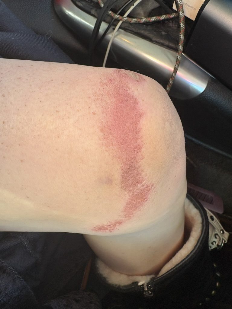 Performer Accuses 101 Modeling of Abuse. The pictures are shocking.